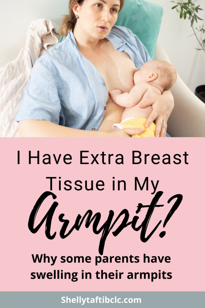breast engorgement blog post