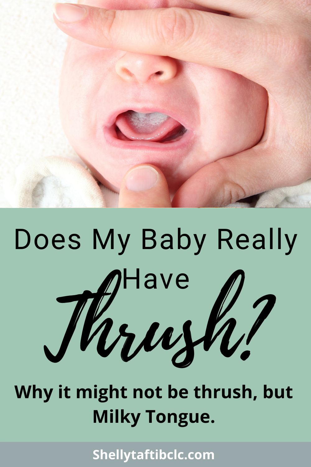 Does my baby have thrush